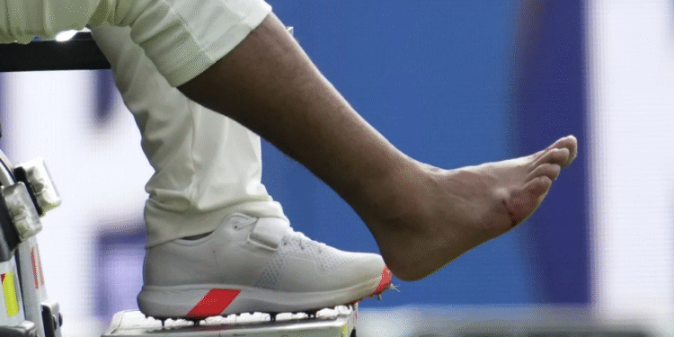 இங்கிலாந்துடனான 4ஆவது டெஸ்டில் பான்ட் உபாதைக்குள்ளாகி ஓய்வுபெற்றார்; இந்தியா 264 – 4 விக்.