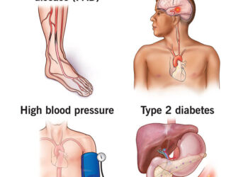 கொலஸ்ரோலை அறிந்து கொள்வது எப்படி?