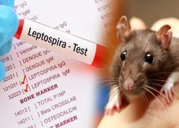 எலிக்காய்ச்சல் : 12 மாவட்டங்களுக்கு எச்சரிக்கை!