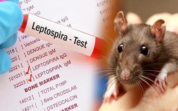 எலிக்காய்ச்சல் : 12 மாவட்டங்களுக்கு எச்சரிக்கை!