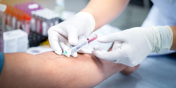 இரத்தப் பரிசோதனை அவசியம்