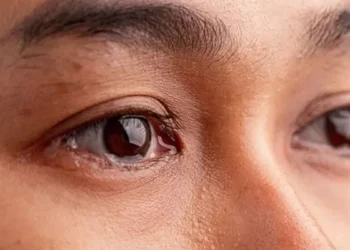 கண் தொற்றுகள் குறித்த எச்சரிக்கை!