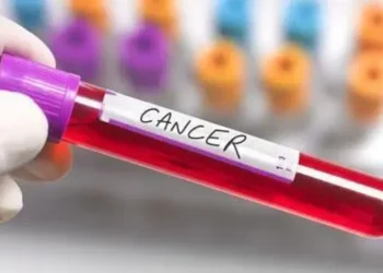 இலங்கையில் புற்றுநோய் தாக்கம் அதிகரித்துள்ளது!