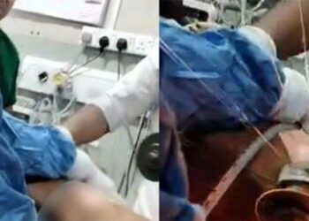 உடலைத் துளைத்த இரும்புக்கம்பி – பதுளை வைத்தியர்களால் அகற்றப்பட்டது