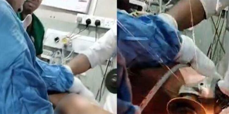 உடலைத் துளைத்த இரும்புக்கம்பி – பதுளை வைத்தியர்களால் அகற்றப்பட்டது