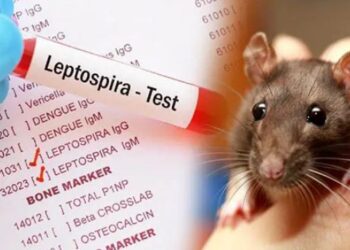 நாட்டில் தீவிரமாகும் எலிக்காய்ச்சல் பரவல்!