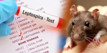 நாட்டில் தீவிரமாகும் எலிக்காய்ச்சல் பரவல்!