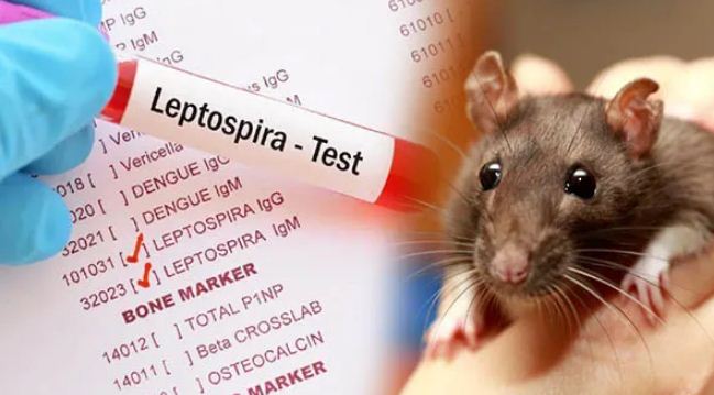 நாட்டில் தீவிரமாகும் எலிக்காய்ச்சல் பரவல்!