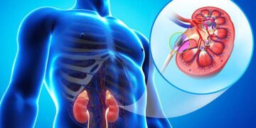 சிறுநீரக நோய் தீவிரம் – இறுதிக்கட்டத்தில் 5,000 பேர்!