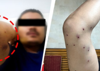 டெல்லி போராட்டம்: பெல்லட் குண்டு சர்ச்சை, களமிறங்கியது CRPF!
