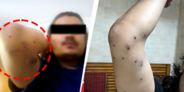 டெல்லி போராட்டம்: பெல்லட் குண்டு சர்ச்சை, களமிறங்கியது CRPF!